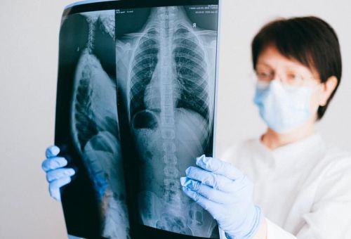 Al CSVP anche la pneumologia e la medicina del sonno